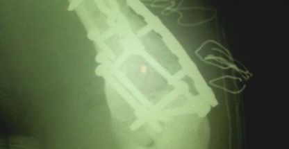 دکتر فریده نجفی