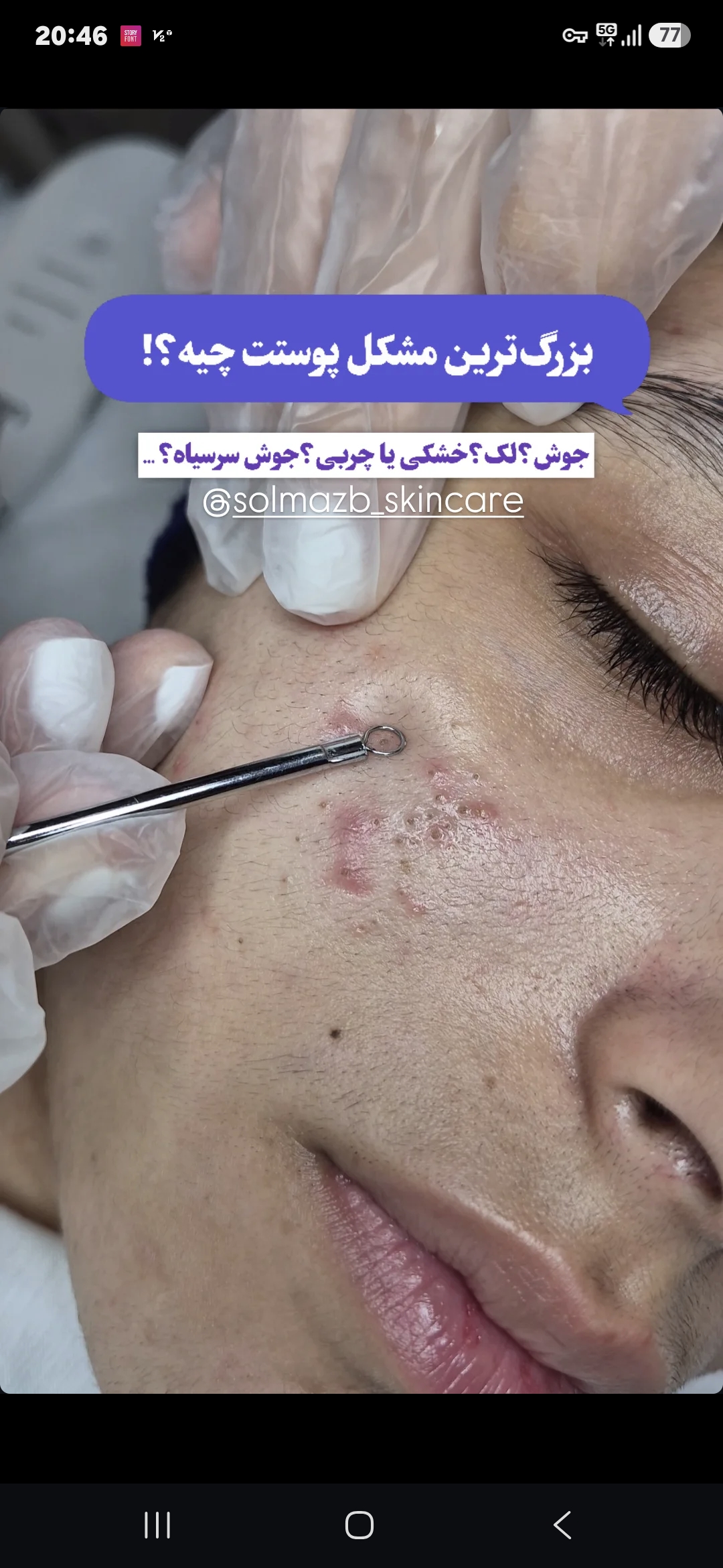 فیشال و پاکسازی تخصصی پوست سولماز