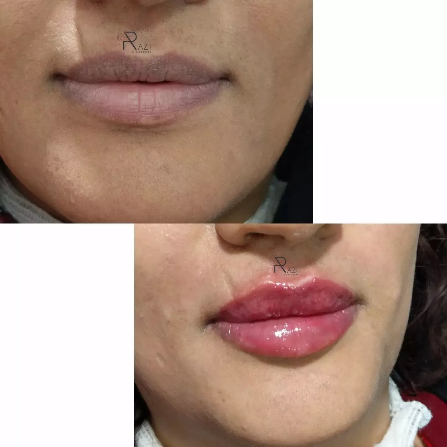 کلینیک پوست و مو رازی