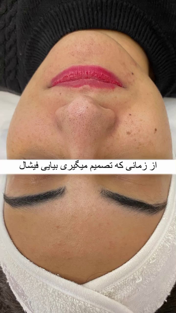 فیشیال وپاکسازی اتاق پوست آزیتا