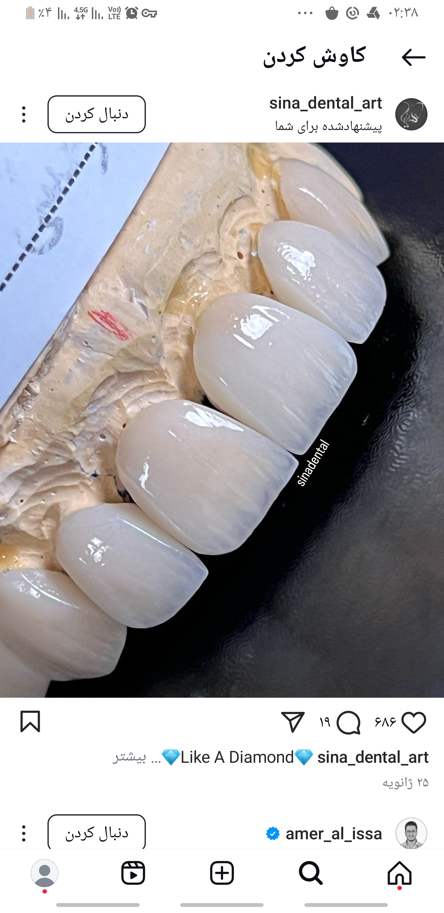 ایمپلنت دکتر حضرتی