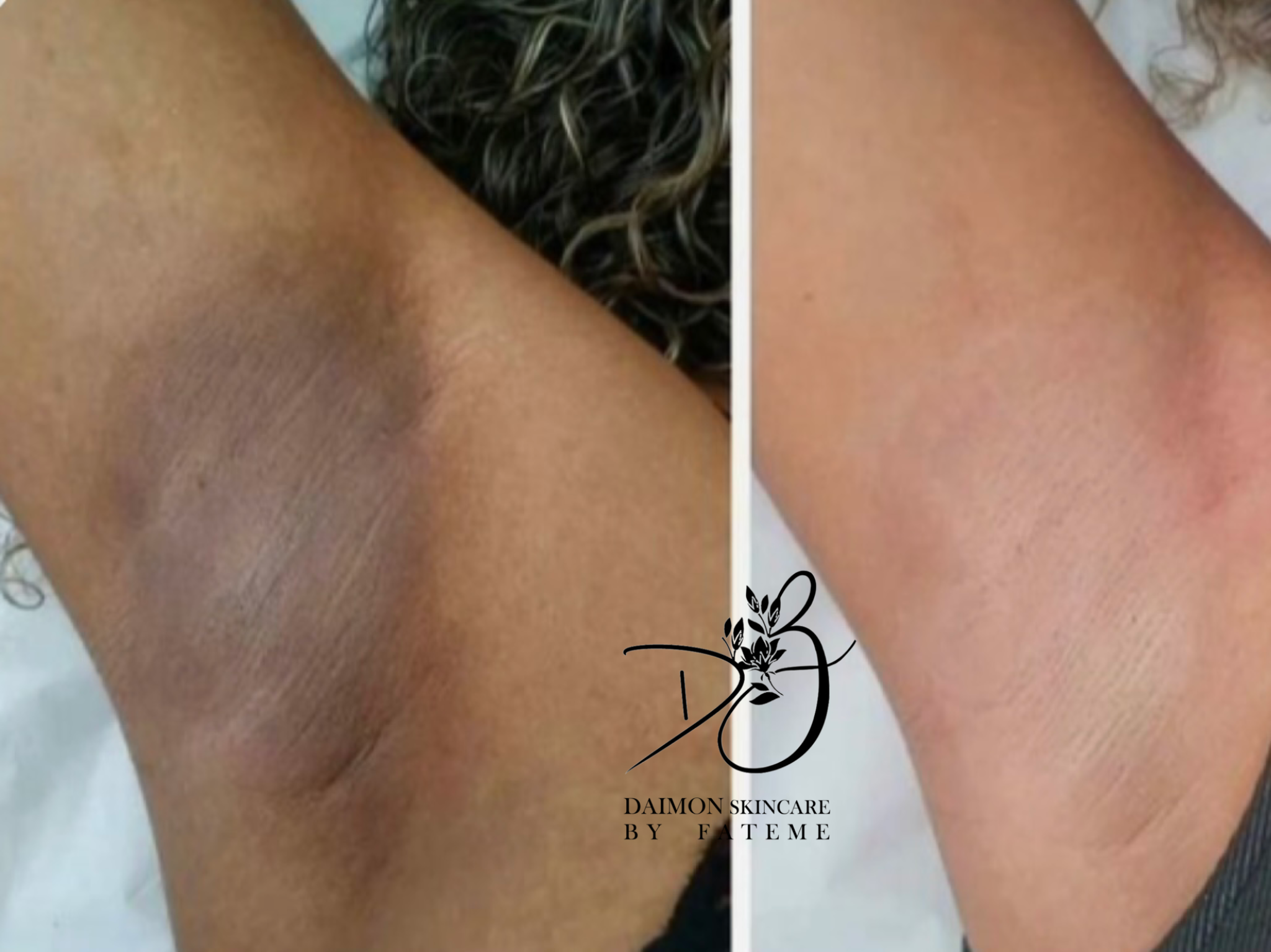 مرکز لیزر و زیبایی دایمون