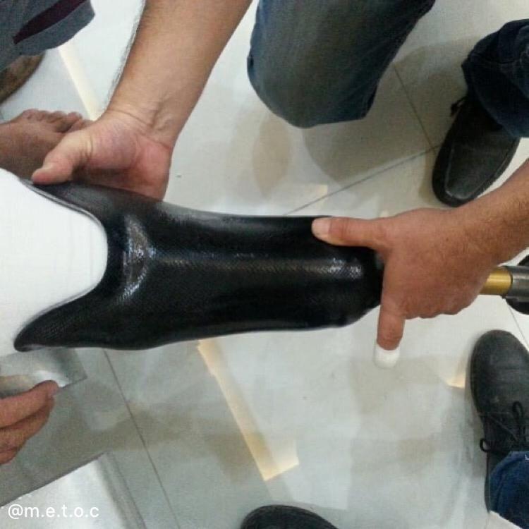 کلینیک ارتوپدی فنی مهر ( اسکن کف پا)