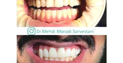 دکتر مهدی مرادی سروستانی