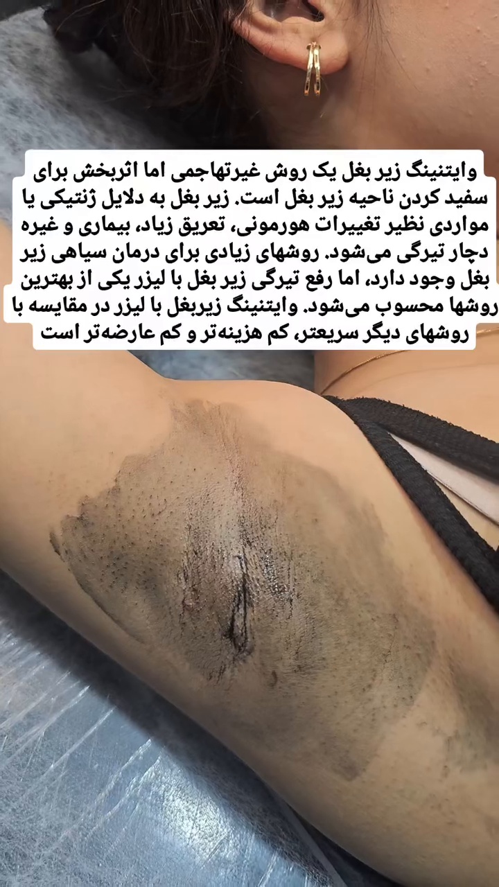 مرکز لیزر و هایفو مختاری