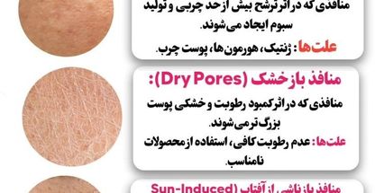 محصولات مراقبتی،زیبایی پوست وموتراست