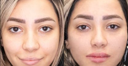 کلینیک پوست مو زیبایی رز