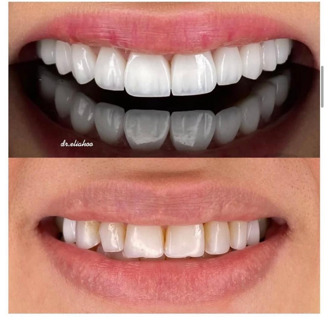 دندانپزشکی دکتر الیاهو