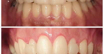 دکتر سلمان ابوالفضلی  متخصص جراحی لثه و ایمپلنت 