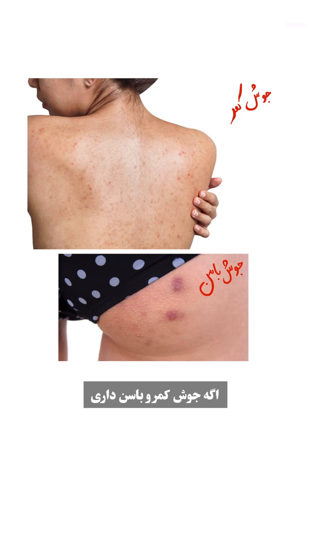 فیشال و خدمات پاکسازی پوست  فاطمه انامی