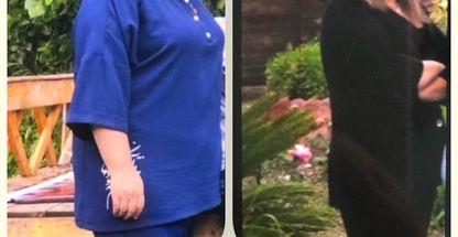 مرکز لاغری بیوتین