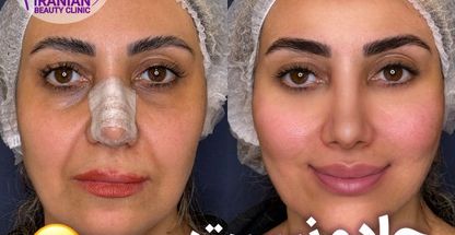 کلینیک تخصصی پوست و مو و لیزر ایرانیان