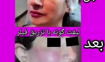 مطب دکتر نفیسه زینعلی