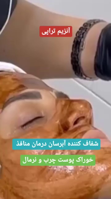 فیشال تخصصی سوزان