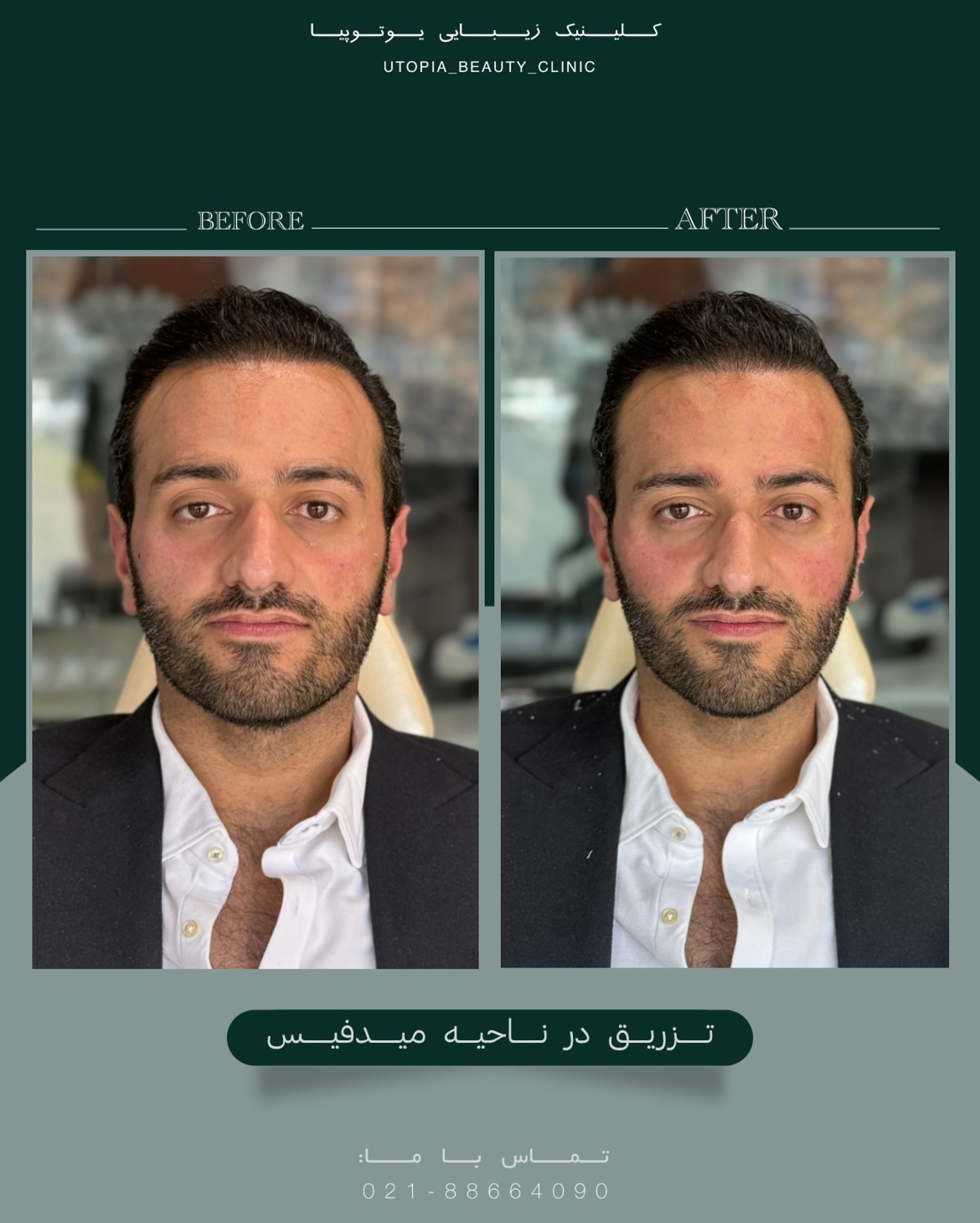 کلینیک زیبایی یوتوپیا