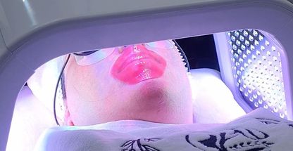 مهناز اسکین کر