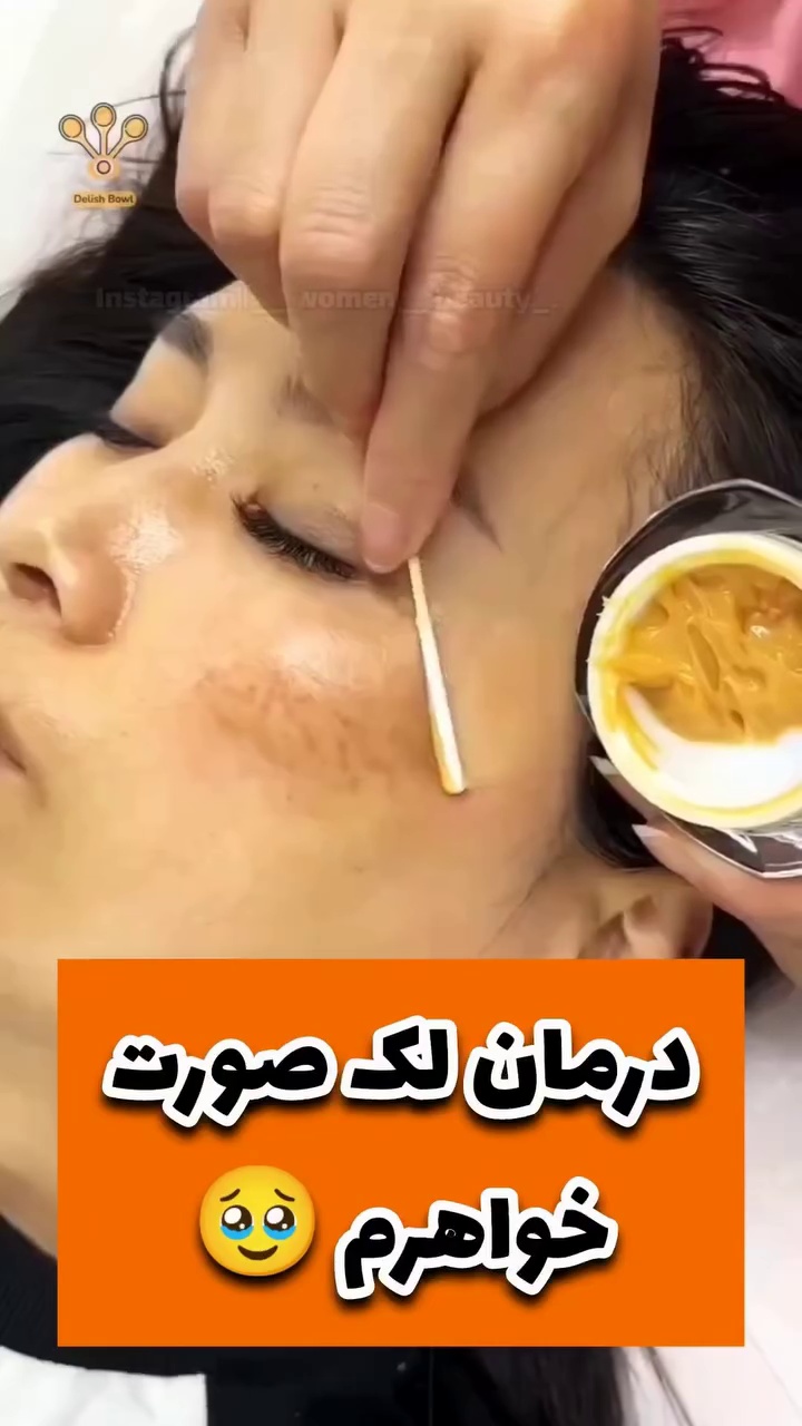 کرم ضدلک وسفیدکننده vip