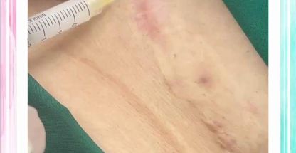 كلينيك زيبايي و ليزر بيوتا (شعبه رسالت)