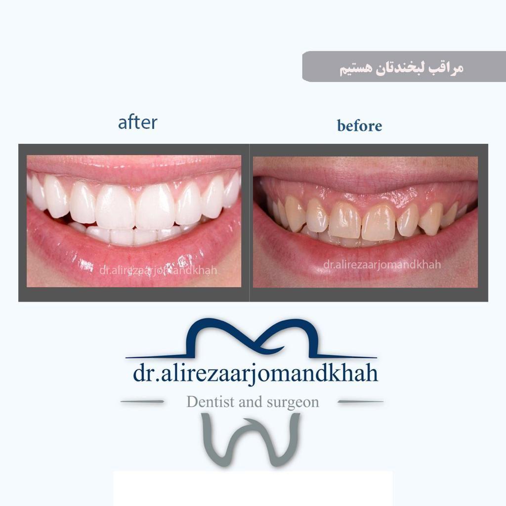 کلینیک دندان پزشکی دکترارجمندخواه اکسیژن