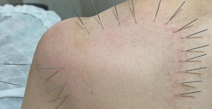 کلینیک فیزیوتراپی و طب سوزنی موحدی