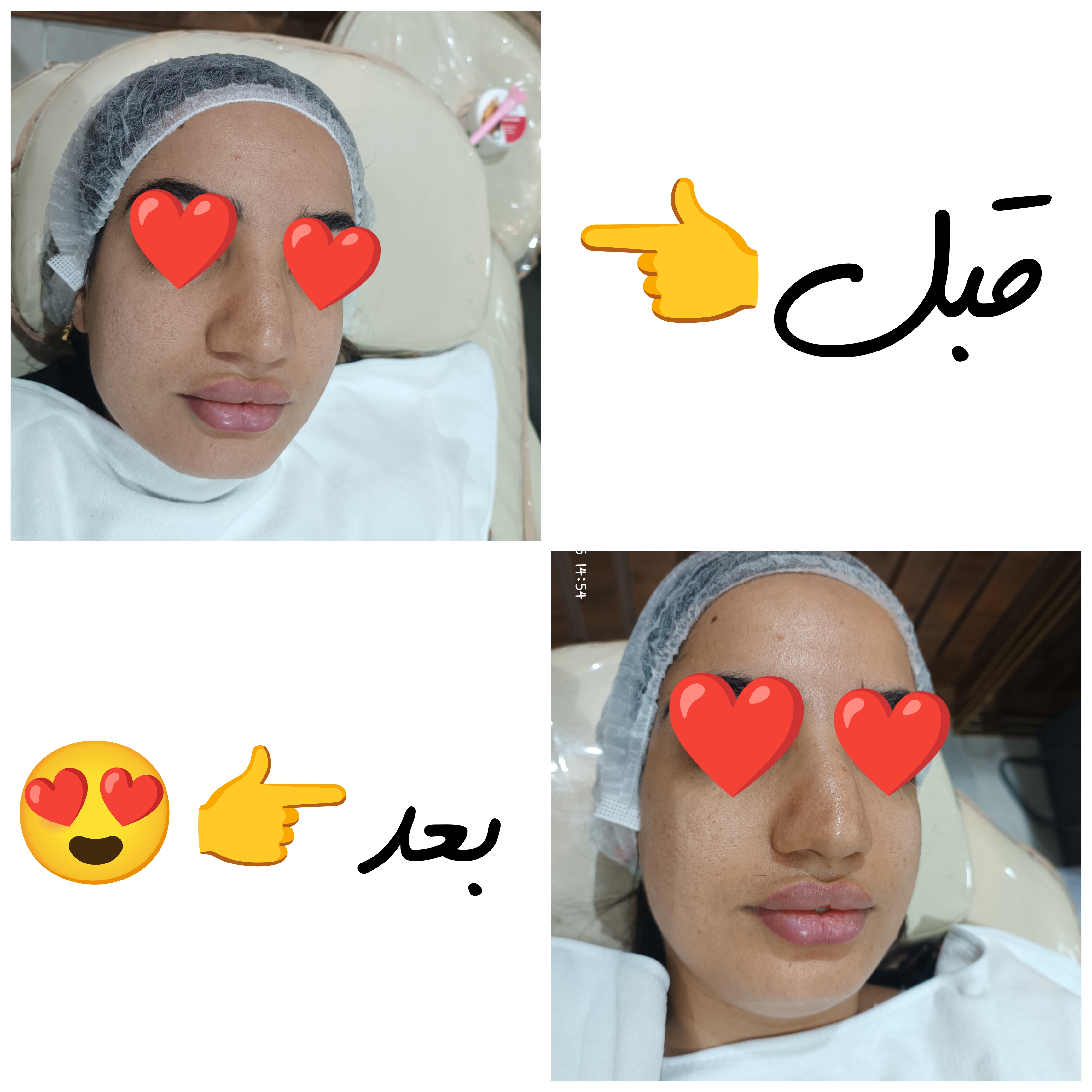 مراقبت پوست زهرا جابری