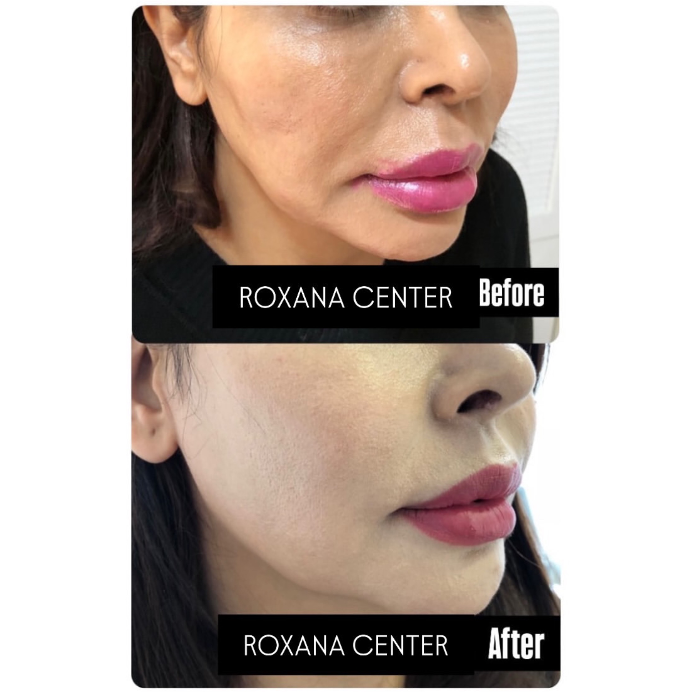 کلینیک پوست مو و زیبایی رکسانا