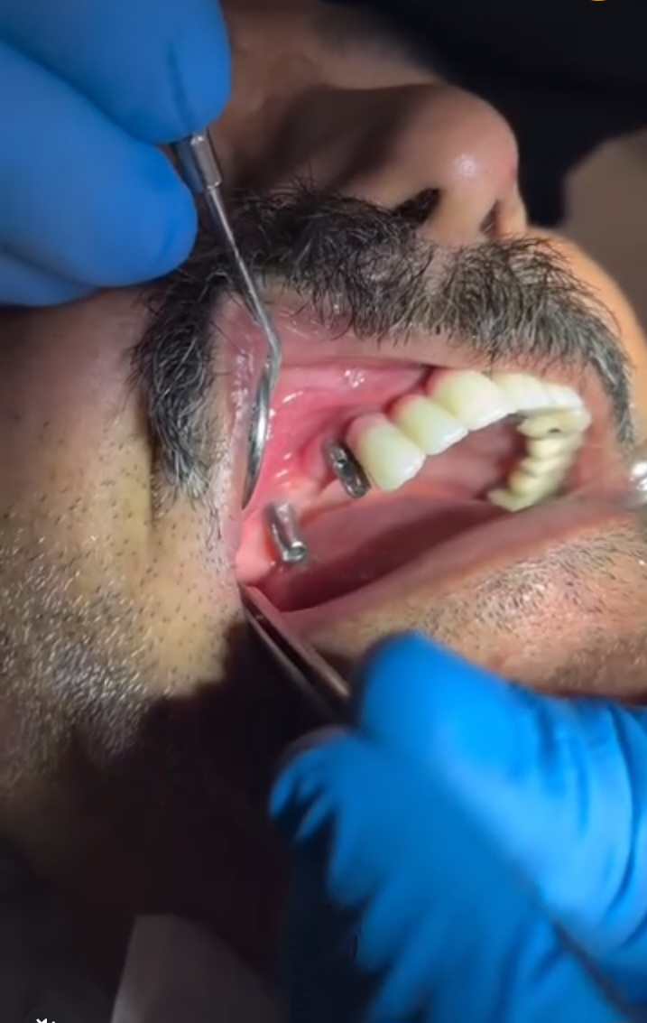 بیمه دندانپزشکی نوین سلامت در مشهد