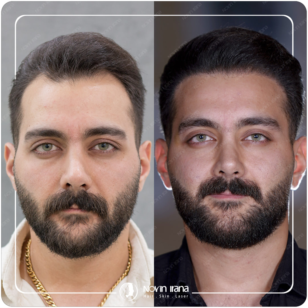 کلینیک پوست مو و زیبایی نوین ایرانا