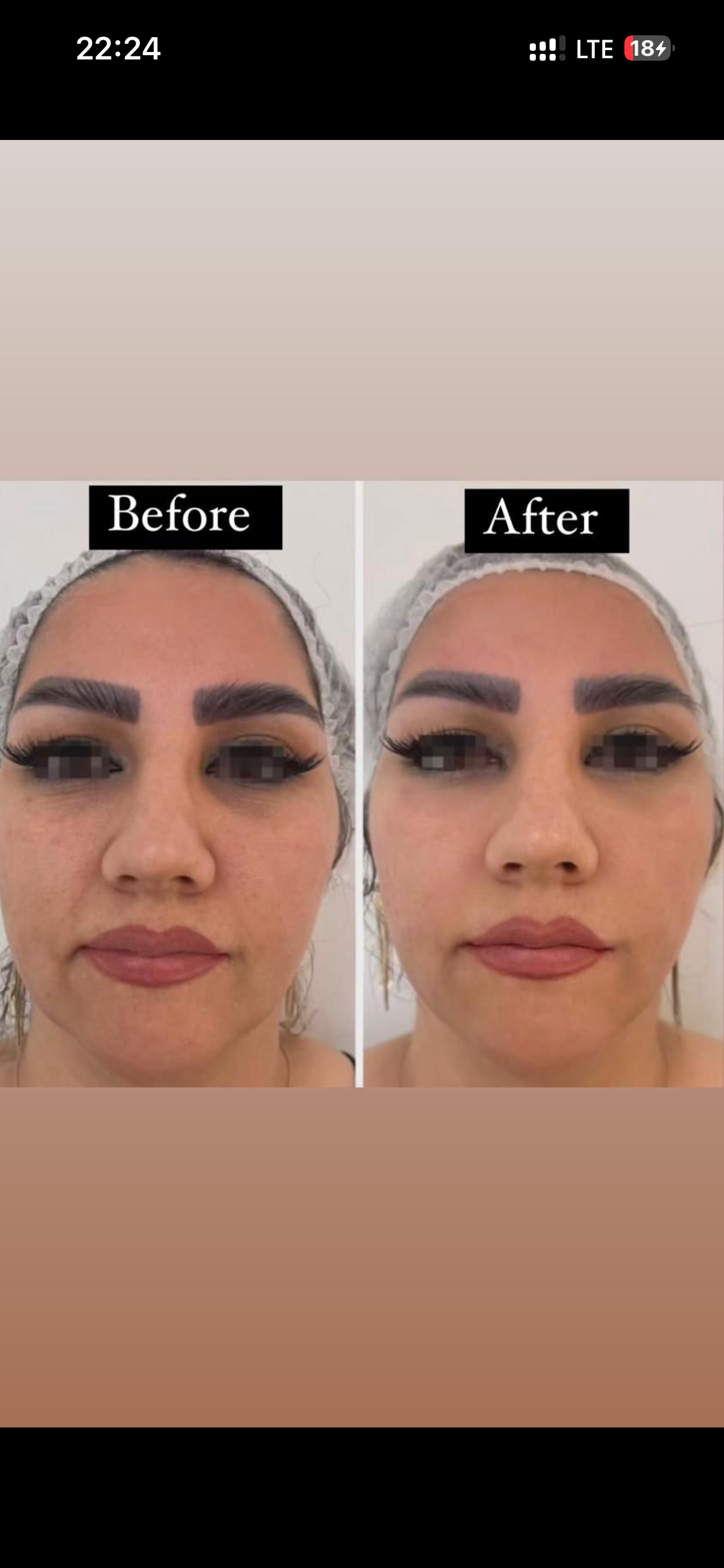 کلینیک زیبایی و لاغری شادرما