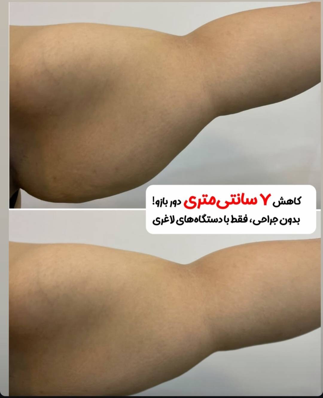 مرکز تخصصی زیبایی، تغذیه و  لاغری پگاه