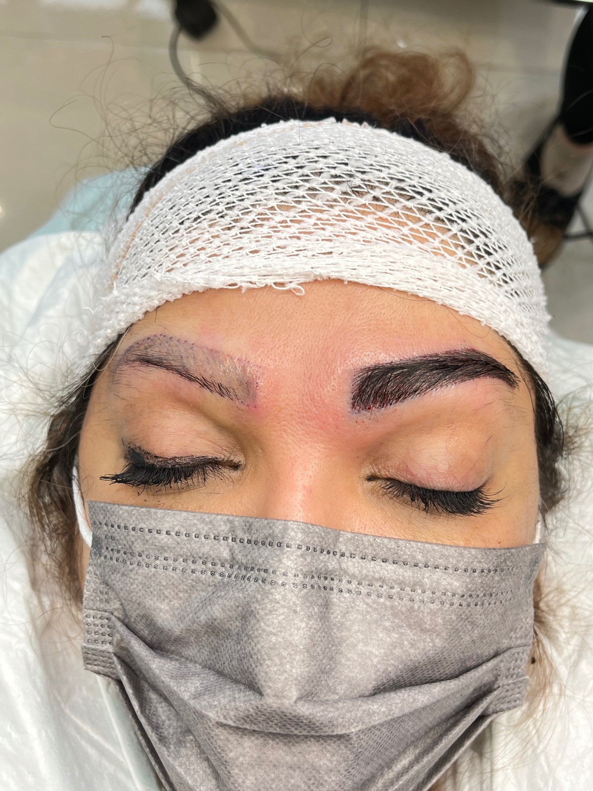 مرکز کاشت ابرو طلائی
