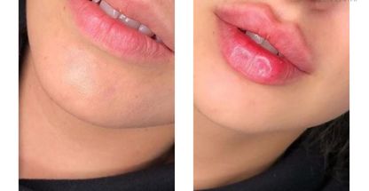 دکتر سمیه جلالی