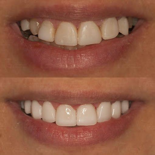 دکتر محمد میرشکار دندانپزشک زیبایی