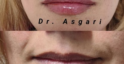 کلینیک زیبایی پوست و لیزر ایده آل