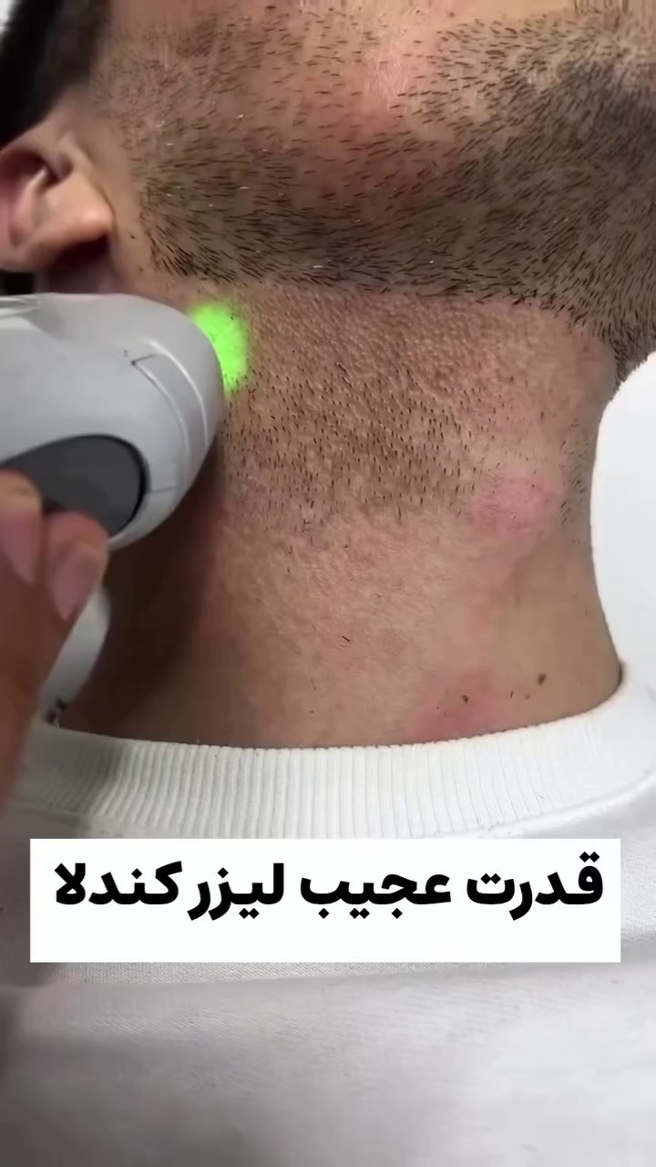 کلینیک زیبایی ولیزر دریا(کندلا آمریکایی)