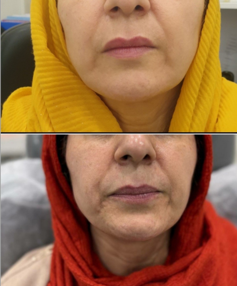 مرکز لیزرو کلینیک زیبایی طراوت