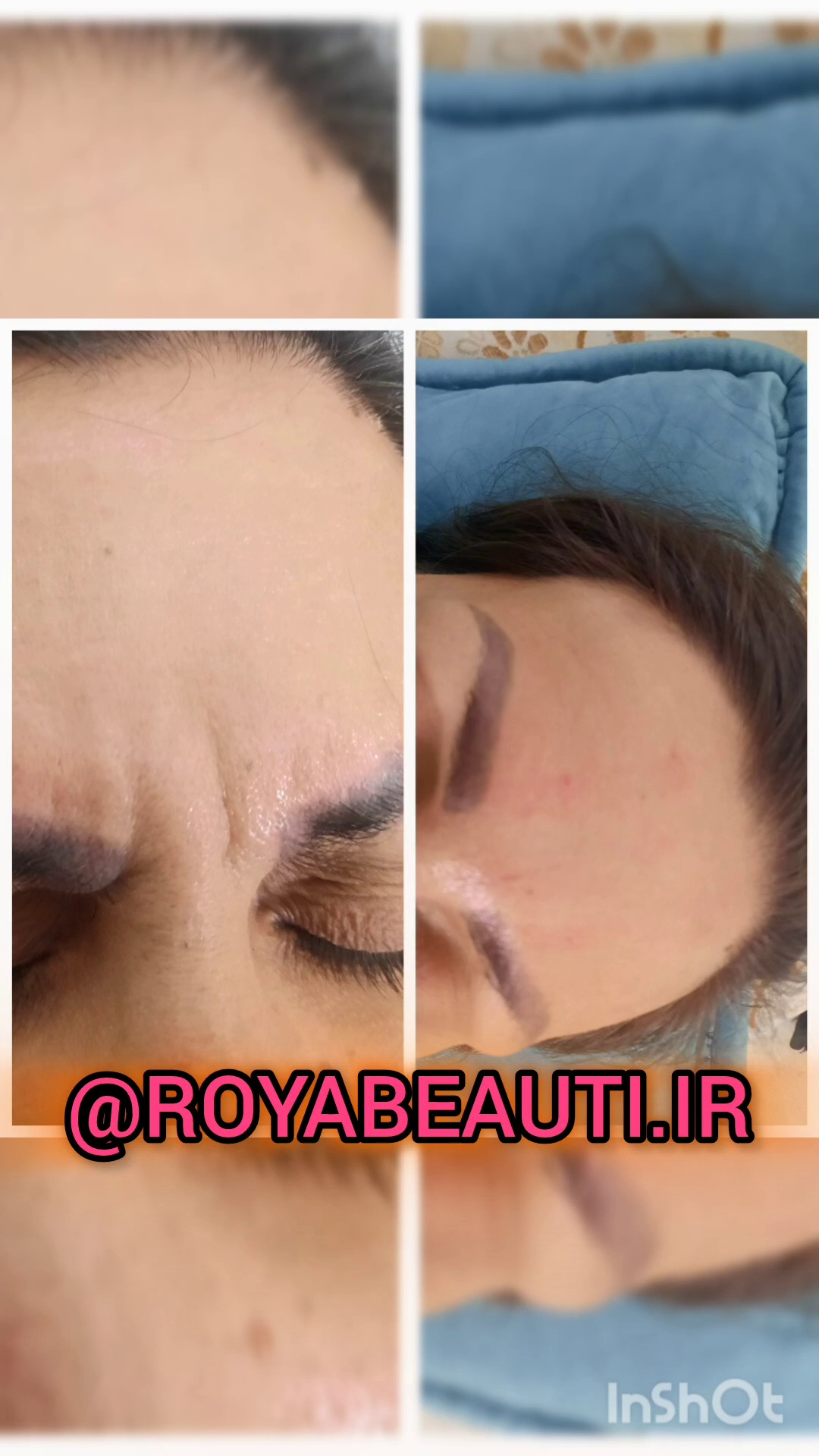 کلینیک زیبایی و درمانی  رویابیوتی
