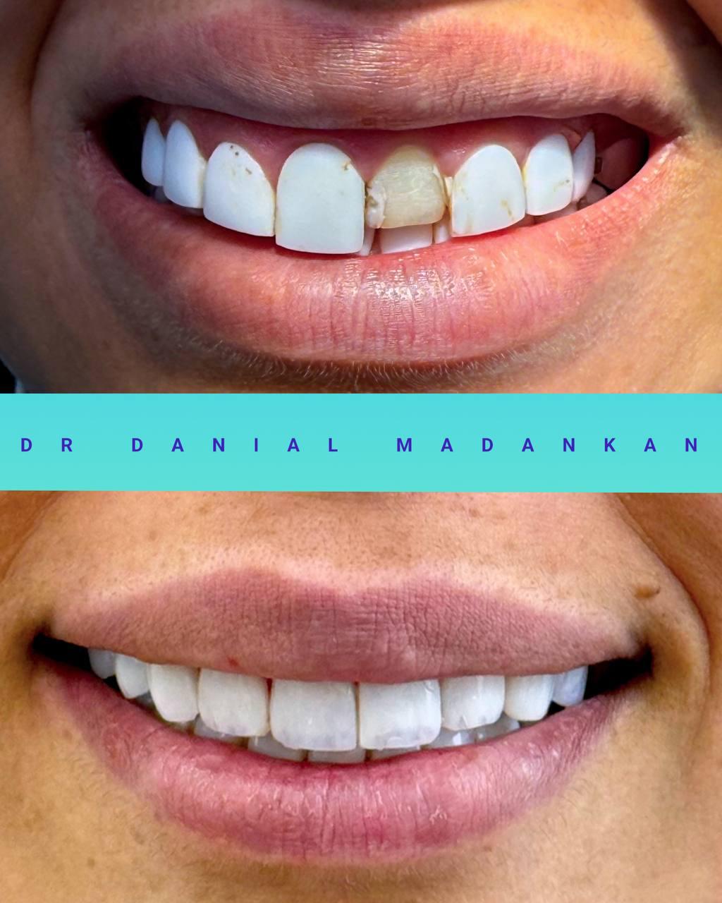 دندانپزشکی رها-دکتر معدن کن