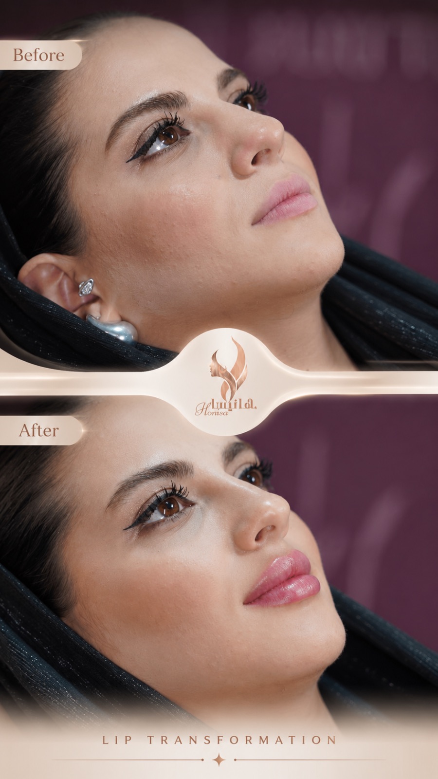 کلینیک زیبایی و مرکز لیزر هانیسا