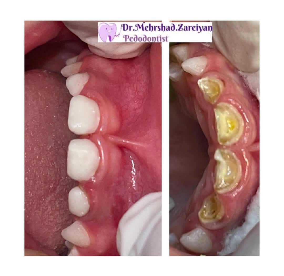 دندانپزشکی دکتر زارعیان متخصص اطفال