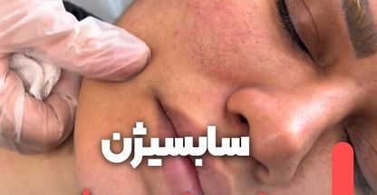 کلینیک پوست و موی تندیس