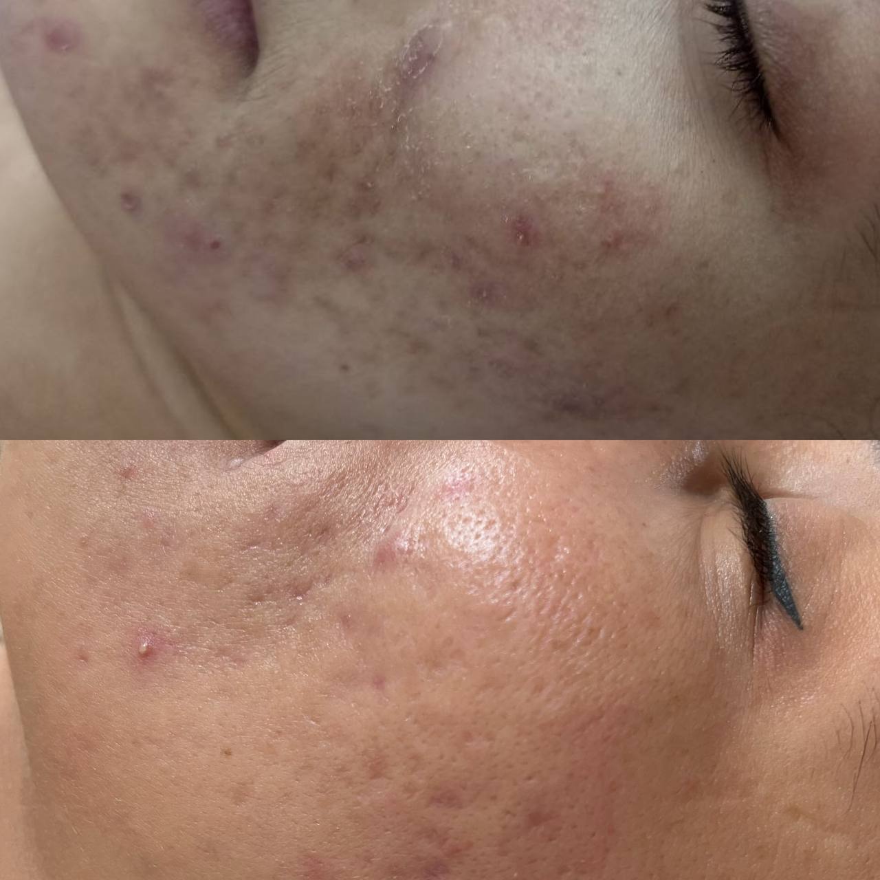 فیشیال فاطمی