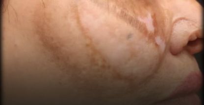 خدمات زیبایی دکتر فیلی