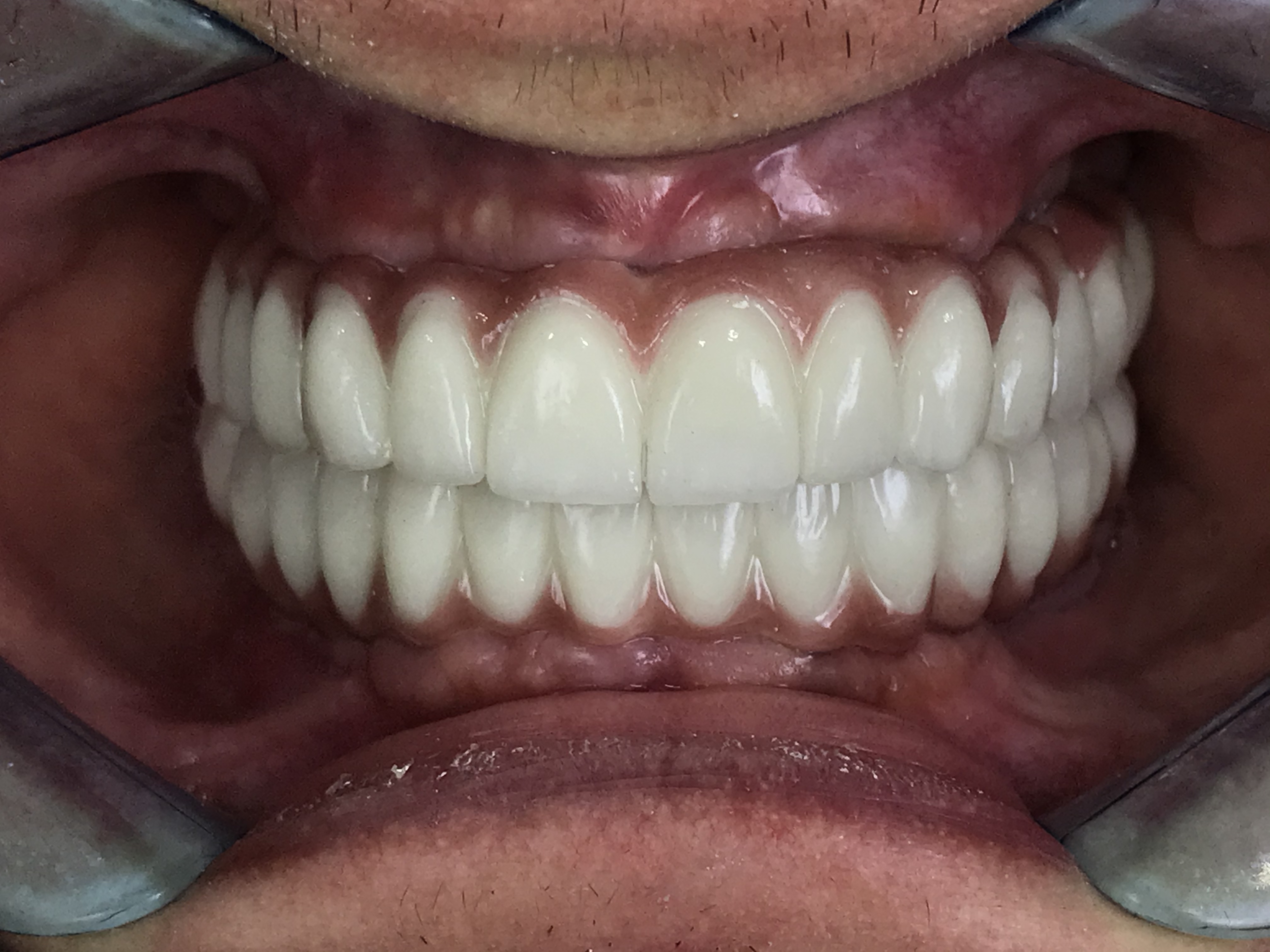 دندانپزشکی دکتر علی ضیائی متخصص ایمپلنت