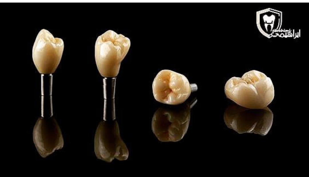 دندانسازی ابراهیمی