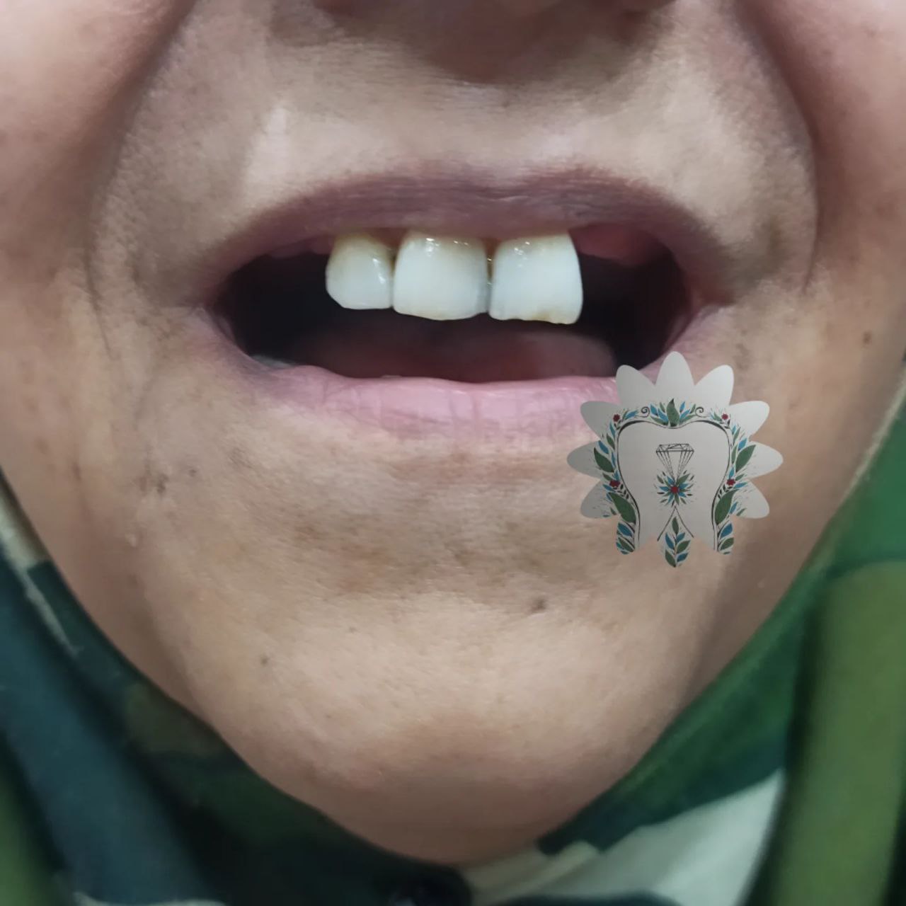 خدمات دندان سازی و جرمگیری