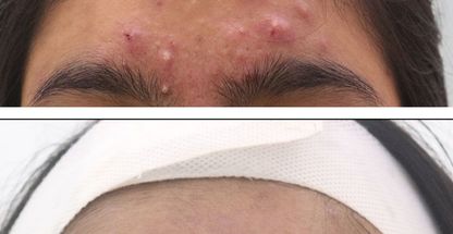 فیشال مهناز فرجی