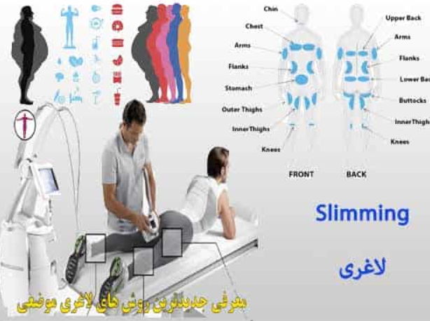 کلینیک لاغری کاشان