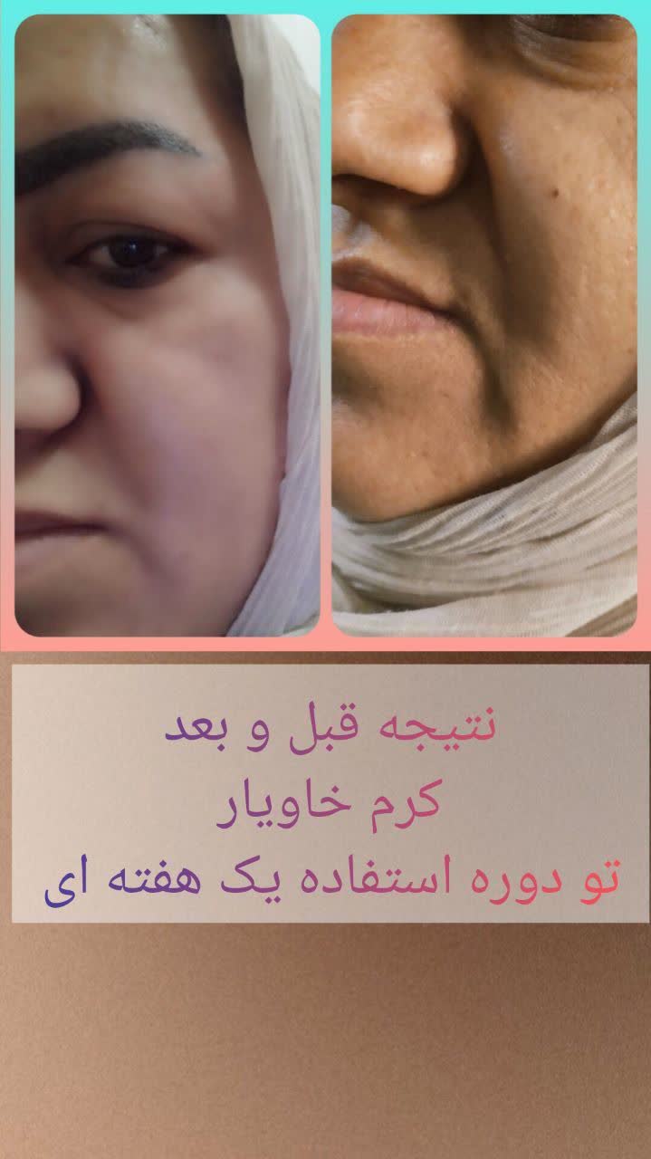 مشاور پوست و مو مهدی زاده