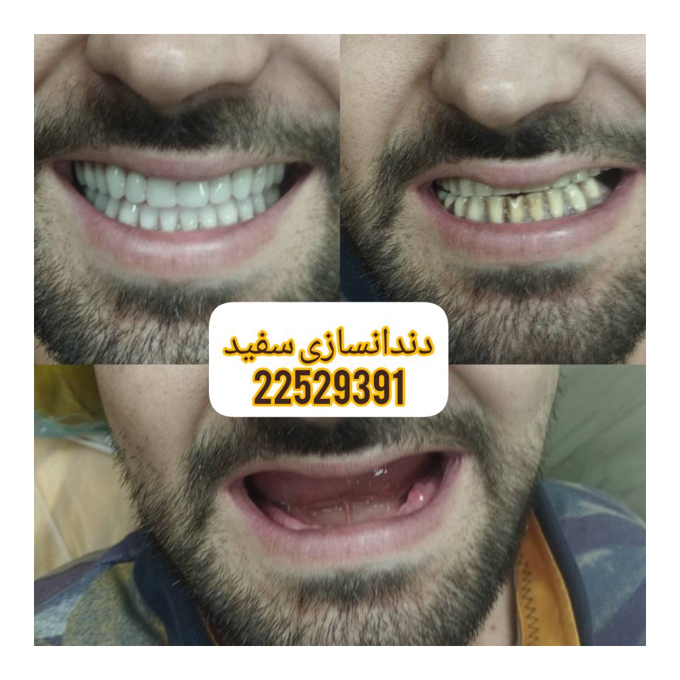 کلینیک دندانسازی دکتر شیواپور